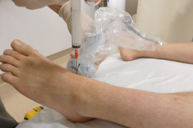 Ankle Injection/Aspiration BCPoCUS